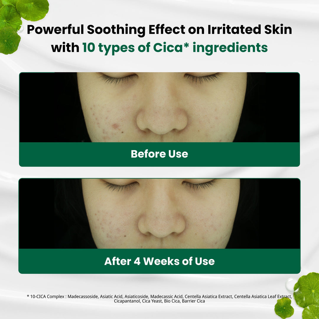 Dr.G Red Blemish Clear Soothing Cream – Korean Calming Moisturizer for Redness, Acne-Prone & Sensitive Skin | Barrier Repair Face Cream