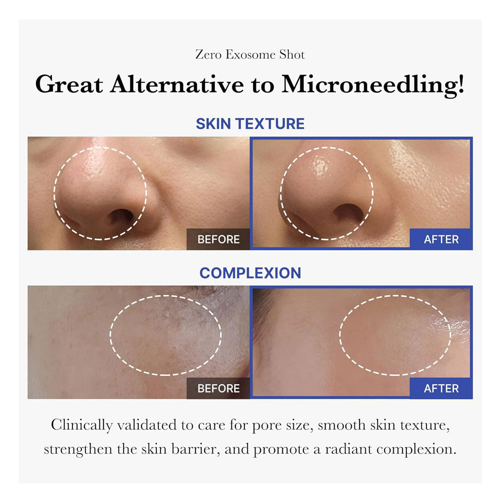 Medicube One Day Exosome Shot Pore Ampoule 2000 – 30ml Korean Pore Refining & Skin Renewal Serum