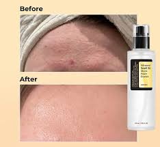 COSRX Advanced Snail 96 Mucin Power Essence – Korean Hydrating Essence for Repair, Glow & Skin Barrier Strengthening